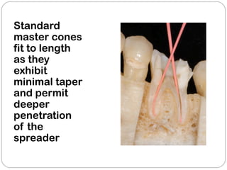 Standard
master cones
fit to length
as they
exhibit
minimal taper
and permit
deeper
penetration
of the
spreader
 