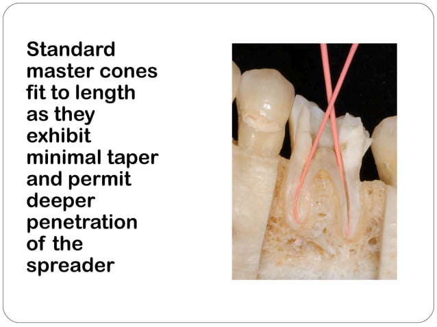 Obturation techniques | PPT