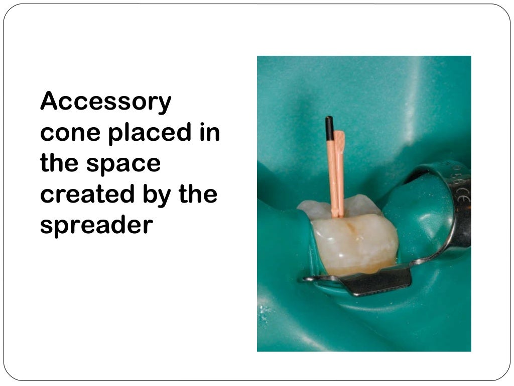 Obturation techniques