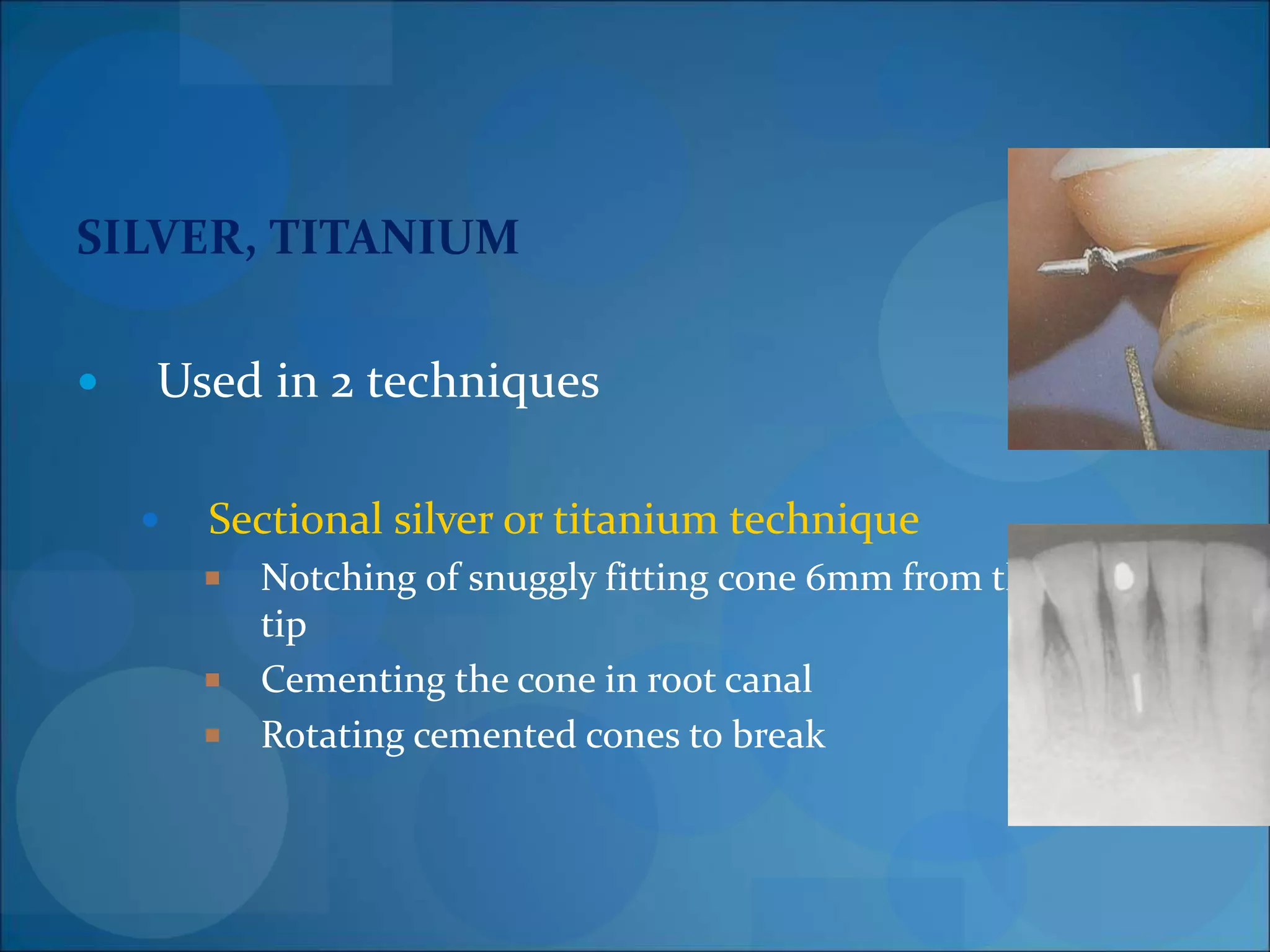 obturation techniques | PPT