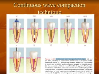 Continuous wave compaction
Continuous wave compaction
technique
technique
 