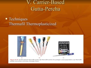 V. Carrier-Based
V. Carrier-Based
Gutta-Percha
Gutta-Percha
 Techniques
Techniques
Thermafil Thermoplasticized
Thermafil Thermoplasticized
 