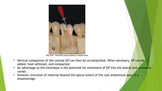 obturation techniques in endodontics.pptx