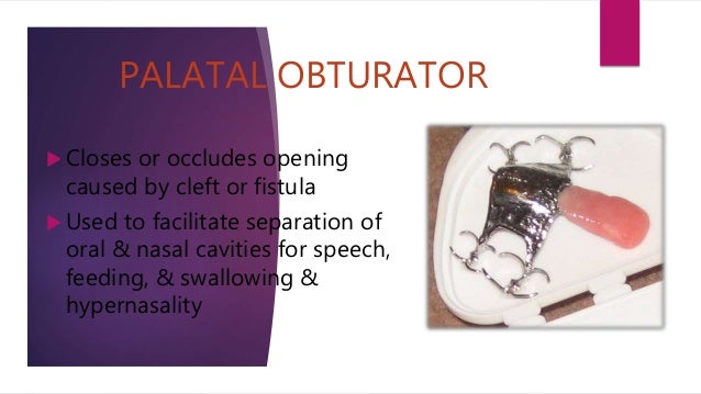 Obturator Prosthesis Definition  : Indication Of Suersen Obturator Prosthesis Rehabilitation.