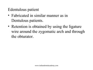Edentulous patient
• Fabricated in similar manner as in
Dentulous patients.
• Retention is obtained by using the ligature
...