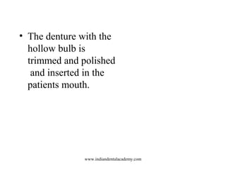 • The denture with the
hollow bulb is
trimmed and polished
and inserted in the
patients mouth.

www.indiandentalacademy.co...