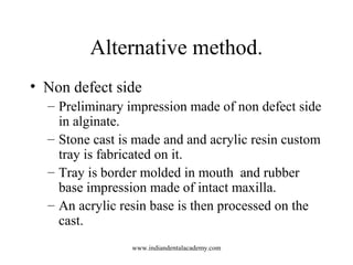 Alternative method.
• Non defect side
– Preliminary impression made of non defect side
in alginate.
– Stone cast is made a...
