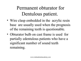 Permanent obturator for
Dentulous patient.
• Wire clasp embedded in the acrylic resin
base are usually used when the progn...