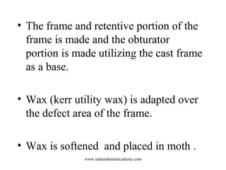 • The frame and retentive portion of the
frame is made and the obturator
portion is made utilizing the cast frame
as a bas...