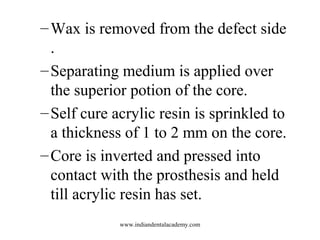 –Wax is removed from the defect side
.
–Separating medium is applied over
the superior potion of the core.
–Self cure acry...