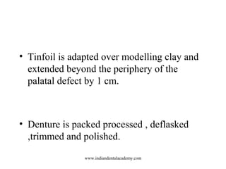 • Tinfoil is adapted over modelling clay and
extended beyond the periphery of the
palatal defect by 1 cm.
• Denture is pac...