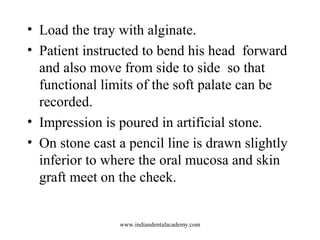 • Load the tray with alginate.
• Patient instructed to bend his head forward
and also move from side to side so that
funct...