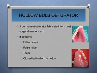False Ridges OBTURATORS in maxillofacial removable Prosthodontics | PPTX