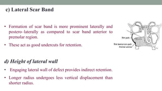 c) Lateral Scar Band
• Formation of scar band is more prominent laterally and
postero–laterally as compared to scar band anterior to
premolar region.
• These act as good undercuts for retention.
d) Height of lateral wall
• Engaging lateral wall of defect provides indirect retention.
• Longer radius undergoes less vertical displacement than
shorter radius.
 