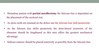 • Dentulous patient with partial maxillectomy the fulcrum line is dependent on
the placement of the occlusal rest.
• As more teeth are retained on the defect site the fulcrum line shift posteriorly.
• As the fulcrum line shifts posteriorly the disto-lateral extension of the
obturator should be lengthened as this area offers the greatest mechanical
advantage.
• Indirect retainer should be placed anteriorly as possible from the fulcrum line.
 