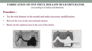 FABRICATION OF ONE PIECE HOLLOW BULB OBTURATOR
(According to Chalian and Barnett)
Procedure :
• Try the trial denture in the mouth and make necessary modifications.
• Boil out the wax in the conventional manner.
• Block out the undercut area in the cast of the defect.
 