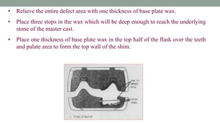 • Relieve the entire defect area with one thickness of base plate wax.
• Place three stops in the wax which will be deep enough to reach the underlying
stone of the master cast.
• Place one thickness of base plate wax in the top half of the flask over the teeth
and palate area to form the top wall of the shim.
 