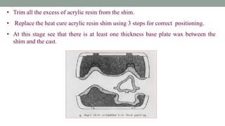 • Trim all the excess of acrylic resin from the shim.
• Replace the heat cure acrylic resin shim using 3 stops for correct positioning.
• At this stage see that there is at least one thickness base plate wax between the
shim and the cast.
 