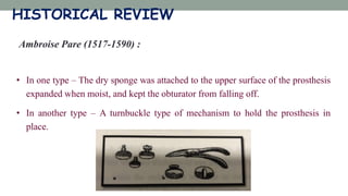 Ambroise Pare (1517-1590) :
• In one type – The dry sponge was attached to the upper surface of the prosthesis
expanded when moist, and kept the obturator from falling off.
• In another type – A turnbuckle type of mechanism to hold the prosthesis in
place.
HISTORICAL REVIEW
 