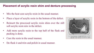• Mix the heat cure acrylic resin in the usual manner.
• Place a layer of acrylic resin in the bottom of the defect.
• Reinsert the processed acrylic resin shim over the still
soft acrylic resin mix in the defect.
• Add more acrylic resin to the top half of the flask and
packing is done.
• Cure the resin in the usual manner.
• De-flask it and trim and polish in usual manner.
Placement of acrylic resin shim and denture processing
 