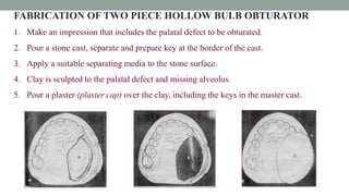 FABRICATION OF TWO PIECE HOLLOW BULB OBTURATOR
1. Make an impression that includes the palatal defect to be obturated.
2. Pour a stone cast, separate and prepare key at the border of the cast.
3. Apply a suitable separating media to the stone surface.
4. Clay is sculpted to the palatal defect and missing alveolus.
5. Pour a plaster (plaster cap) over the clay, including the keys in the master cast.
 