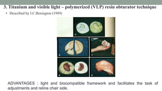 3. Titanium and visible light – polymerized (VLP) resin obturator technique
• Described by I.C.Benington (1989)
ADVANTAGES : light and biocompatible framework and facilitates the task of
adjustments and reline chair side.
 