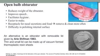 Open bulb obturator
• Reduces weight of the obturator.
• Improves speech .
• Facilitates hygiene .
• Easier to make.
• Receptacle for nasal secretions and food  remove & clean more often
• Difficulty in polishing internal surface
Shifman, A. (1983). A technique for the fabrication of the open obturator. The Journal of Prosthetic Dentistry, 50(3), 384–385. doi:10.1016/s0022-
3913(83)80098-5
An alternative is an obturator with removable lid
given by Arie Shifman 1983.
Thin and small lid can be made up of vacuum formed
thermoplastic resin sheets
 