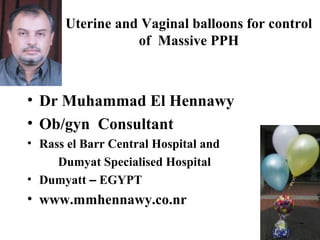 Uterine and Vaginal balloons for control
of Massive PPH
• Dr Muhammad El Hennawy
• Ob/gyn Consultant
• Rass el Barr Central Hospital and
Dumyat Specialised Hospital
• Dumyatt – EGYPT
• www.mmhennawy.co.nr
 