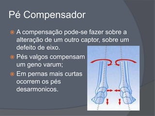 Pé Compensador
 A compensação pode-se fazer sobre a
  alteração de um outro captor, sobre um
  defeito de eixo.
 Pés valgos compensam
  um geno varum;
 Em pernas mais curtas
  ocorrem os pés
  desarmonicos.
 