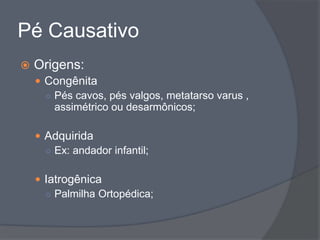 Pé Causativo
   Origens:
     Congênita
      ○ Pés cavos, pés valgos, metatarso varus ,
        assimétrico ou desarmônicos;

     Adquirida
      ○ Ex: andador infantil;


     Iatrogênica
      ○ Palmilha Ortopédica;
 