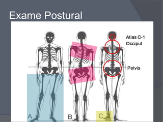 Exame Postural
 