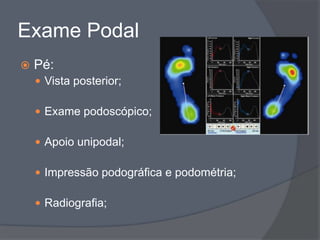 Exame Podal
   Pé:
     Vista posterior;

     Exame podoscópico;

     Apoio unipodal;

     Impressão podográfica e podométria;

     Radiografia;
 