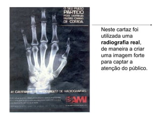 Neste cartaz foi
utilizada uma
radiografia real,
de maneira a criar
uma imagem forte
para captar a
atenção do público.
 