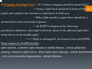 Oculomotor Nerve | PPTX