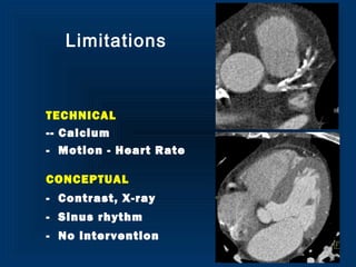 Limitations
TECHNICAL
-- Calcium
- Motion - Heart Rate
CONCEPTUAL
- Contrast, X-ray
- Sinus rhythm
- No intervention
 