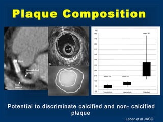 Plaque Composition
Potential to discriminate calcified and non- calcified
plaque
Leber et al JACC
 