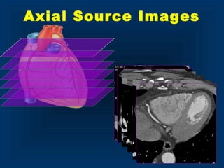 Axial Source Images
 