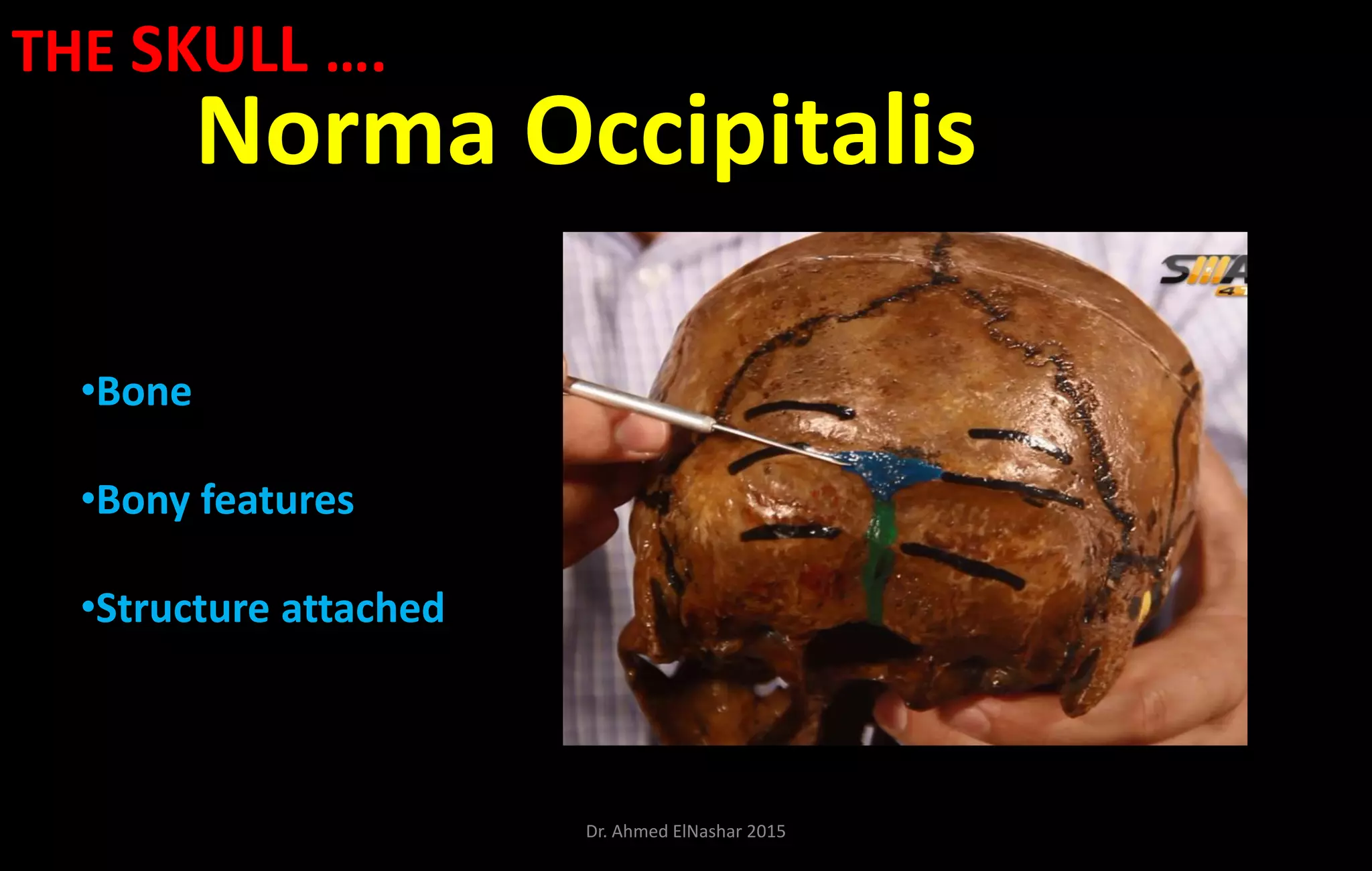 Norma Occipitalis
•Bone
•Bony features
•Structure attached
THE SKULL ….
Dr. Ahmed ElNashar 2015