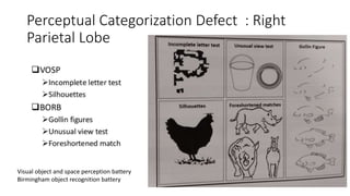 Perceptual Categorization Defect : Right
Parietal Lobe
Visual object and space perception battery
Birmingham object recognition battery
 