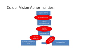 Colour Vision Abnormalities
 