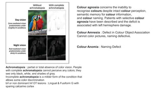 Achromatopsia : partial or total absence of color vision. People
with complete achromatopsia cannot perceive any colors; they
see only black, white, and shades of gray.
Incomplete achromatopsia is a milder form of the condition that
allows some color discrimination
b/l or non dominant Inf OT lesions : Lingual & Fusiform G with
sparing calcarine cortex
Colour agnosia concerns the inability to
recognise colours despite intact colour perception,
semantic memory for colour information,
and colour naming. Patients with selective colour
agnosia have been described and the deficit is
associated with left hemisphere damage.
Colour Amnesia : Defect in Colour Object Association
Cannot color pictures, naming defective.
Colour Anomia : Naming Defect
 