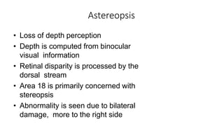 Astereopsis
• Loss of depth perception
• Depth is computed from binocular
visual information
• Retinal disparity is processed by the
dorsal stream
• Area 18 is primarily concerned with
stereopsis
• Abnormality is seen due to bilateral
damage, more to the right side
 