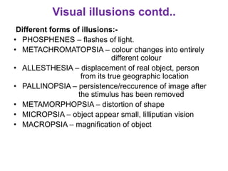 Visual Allesthesia Occipital lobe 2 syndromes nwnw ppt | PPTX