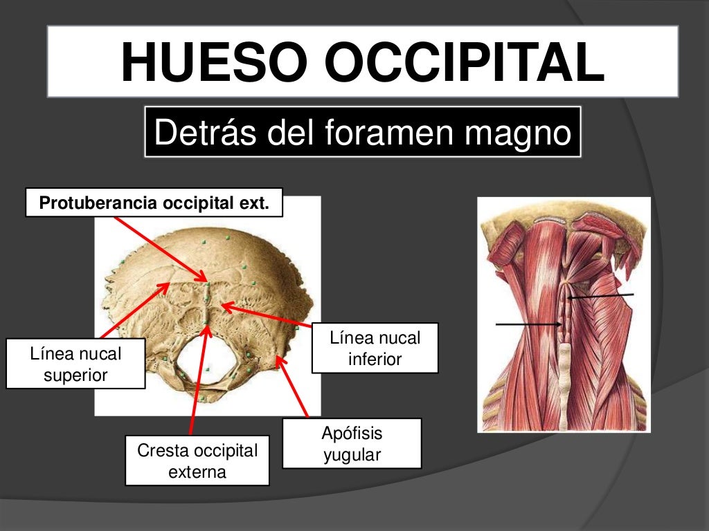 Hueso Occipital