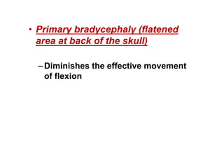 • Primary bradycephaly (flatened
area at back of the skull)
–Diminishes the effective movement
of flexion
 