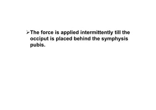 The force is applied intermittently till the
occiput is placed behind the symphysis
pubis.
 