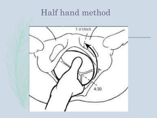 Half hand method
 