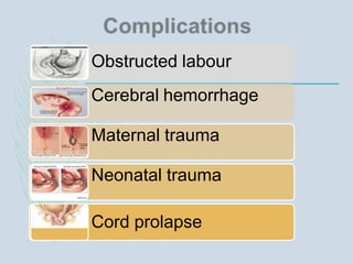 Obstructed labour
Cerebral hemorrhage
Maternal trauma
Neonatal trauma
Cord prolapse
 