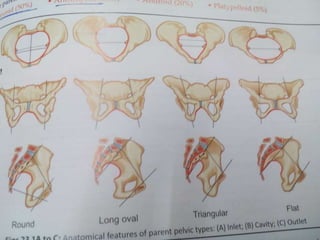 Lateral grip :-Foetal back is felt on rt. Flank of
mother in ROP & in left flank, in LOP.
Fetal limbs are felt easily as k...