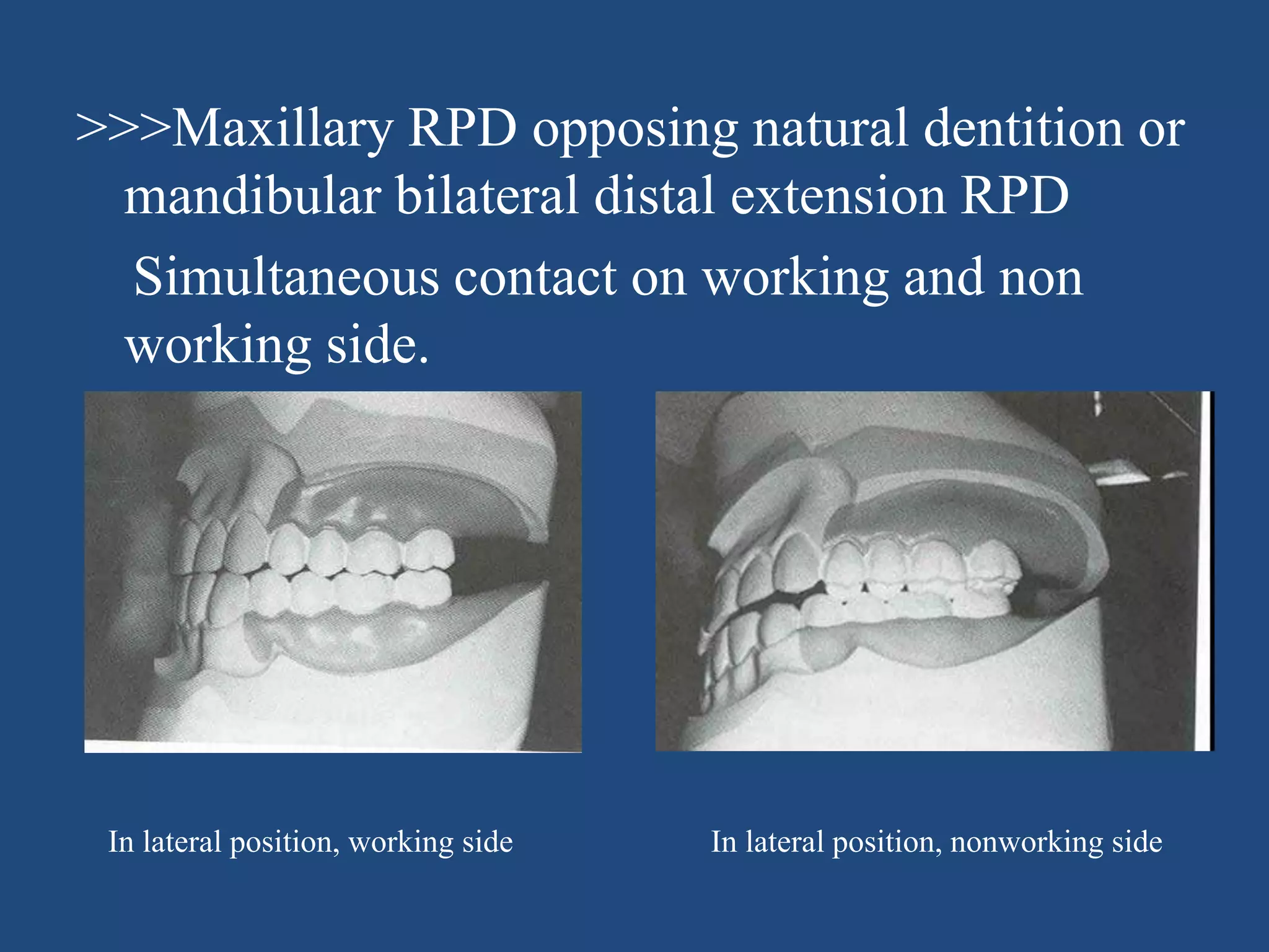 Occluion in prosthodontics lec 16 04-'13 | PPTX